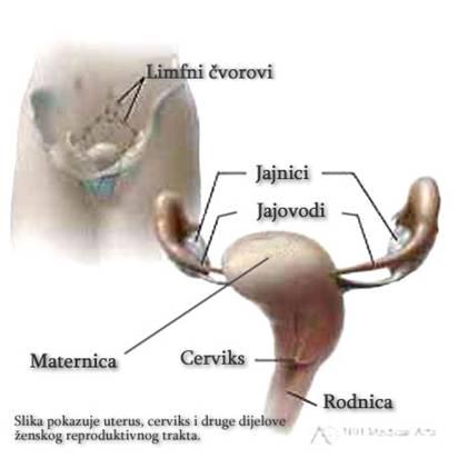 Rak grlića maternice (prevencija, simptomi, dijagnoza i liječenje) Aenski10