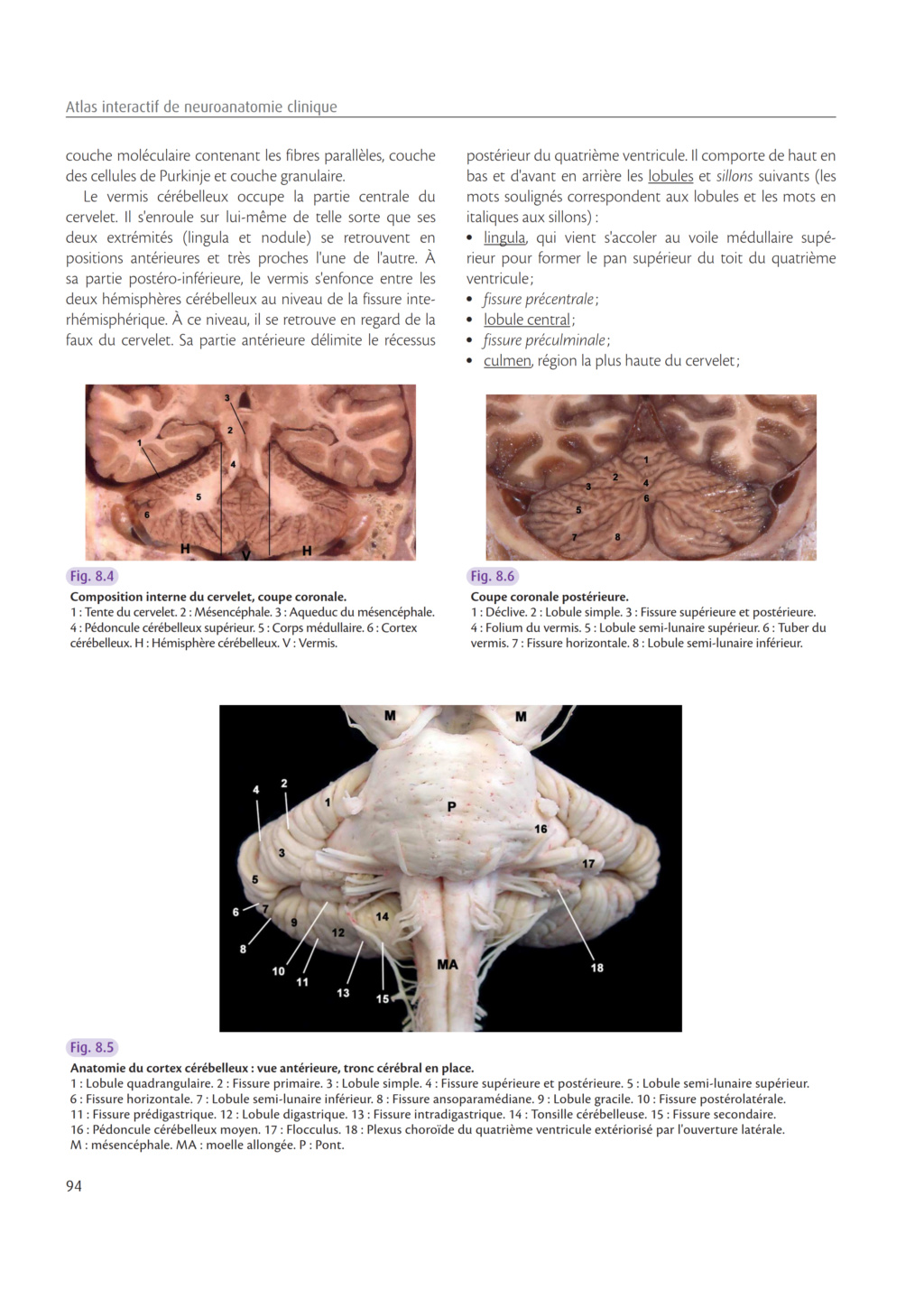 NeuroAnatomie Clinique: Cervelet Thines12