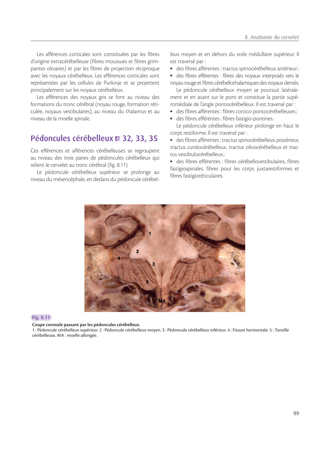 NeuroAnatomie Clinique: Cervelet Thines17