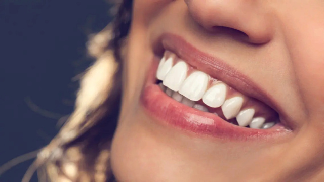 هذه أسهل الحلول التجميلية وأقلها كلفة لتبييض الأسنان  220