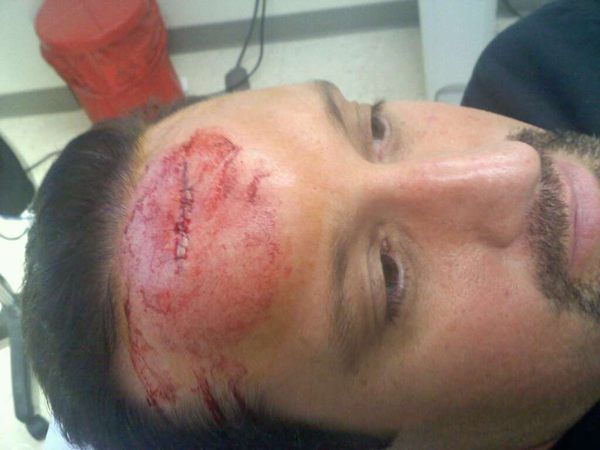 Tommy Dreamer publica imágenes tras ser golpeado por The Shield. Tommy410