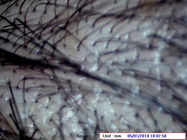 Pics taken using a Microscope Hair1_11