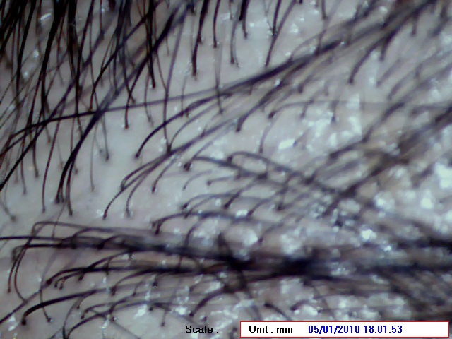 Pics taken using a Microscope Hair2_11