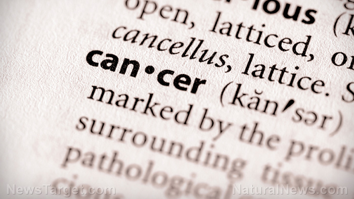 5 MISTAKES MOST PEOPLE MAKE WHEN THEY GET DIAGNOSED WITH CANCER Cancer11