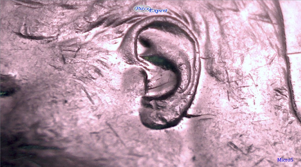 1950 - Aide auditive #2 (Split Hearing Aid) + Multiples Entrechoqués Image123