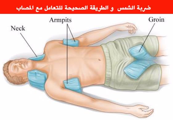  ضربات الشمس 11111202