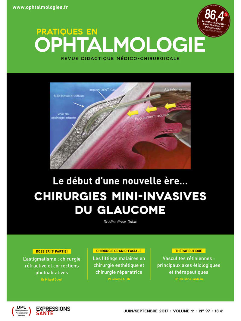 ophtalmologie - Pratiques en ophtalmologie septembre 2017 Img_2110