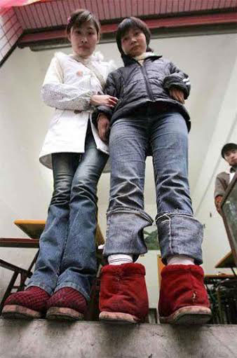  صينية تصمم أحذية لنفسها بعد انقلاب قدميها  للخلف 90fbea10