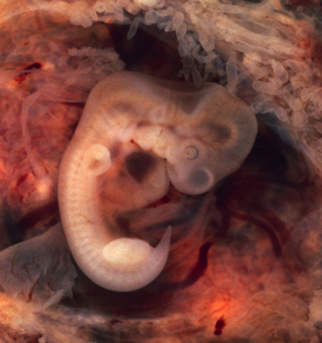 شرح مصور لعملية تخصيب البويضه والحمل عند المرإة Tubal_10