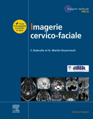 [imagerie]:Imagerie cervico-faciale 2021 pdf gratuit  - Page 8 889210