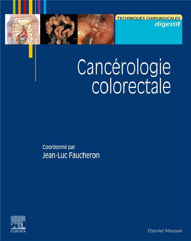 [chirurgie]:2021:Cancérologie colorectale pdf gratuit  - Page 2 Cancer10