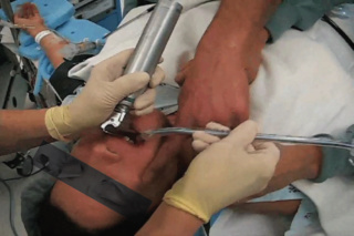 [astuce]:Les secrets d’une intubation réussie Insert10