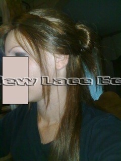 Fotos pelucas en pelo natural - alopecia areata . 10112010