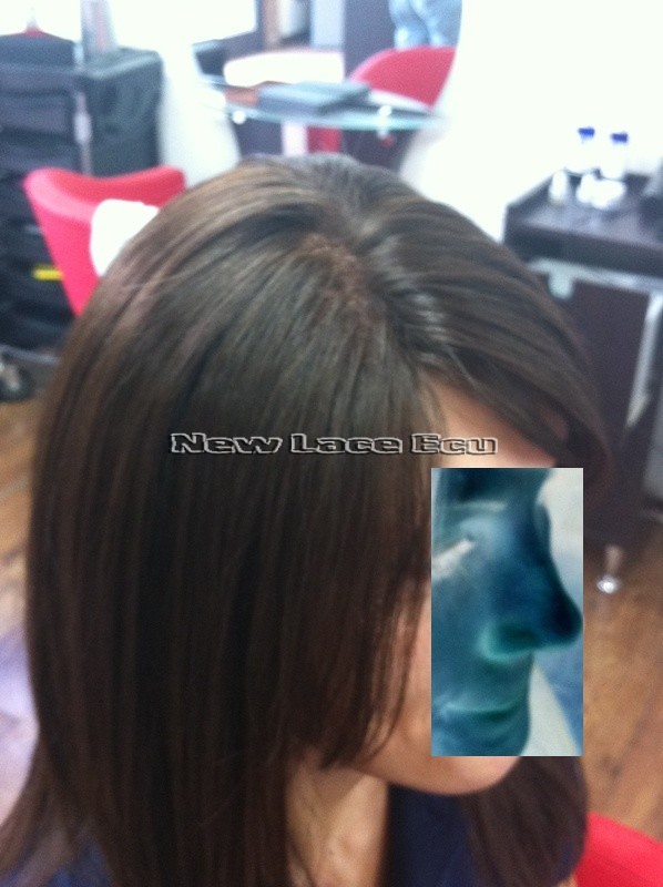 Fotos pelucas en pelo natural - alopecia areata . 2n0oj711