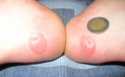 changement de de boots Super_10