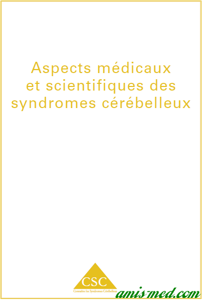 syndrome cerebelleux Syndro10