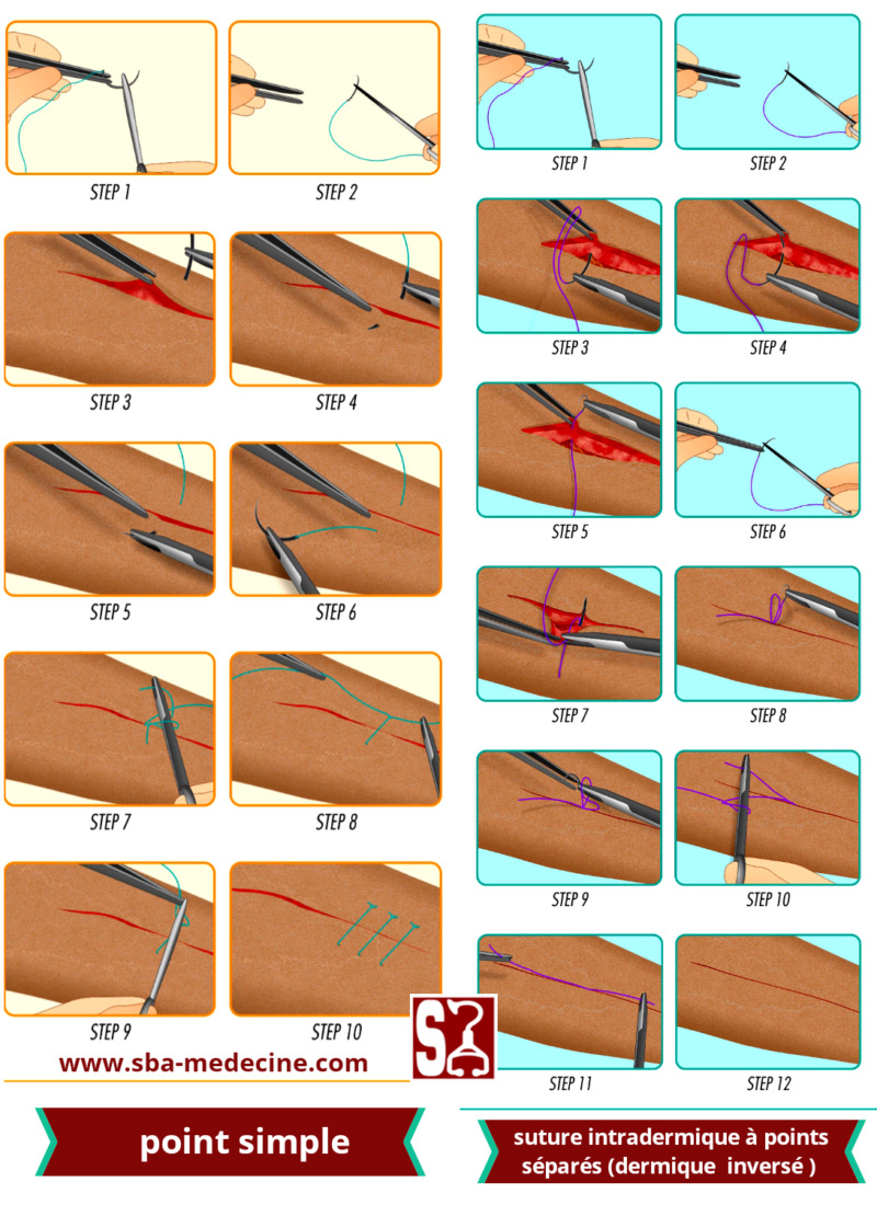 [astuce]:Formation en suture:"Guide complet pour maîtriser les techniques de suture" partie 2 20200918