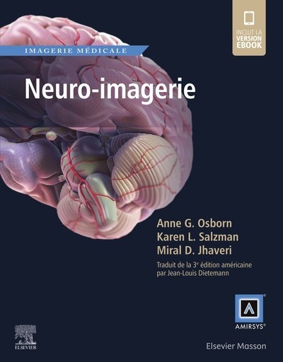 Neuro-imagerie AMIRSYS  PDF gratuit  Neuro-10