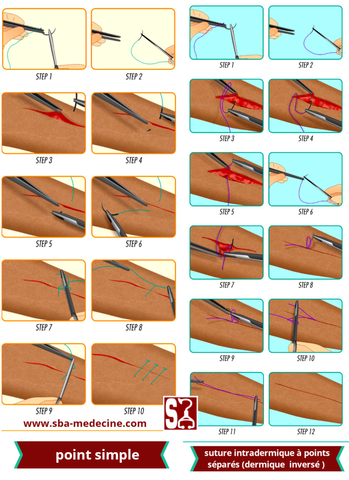 astuce]:Formation en suture:"Guide complet pour maîtriser les techniques de  suture" partie 2