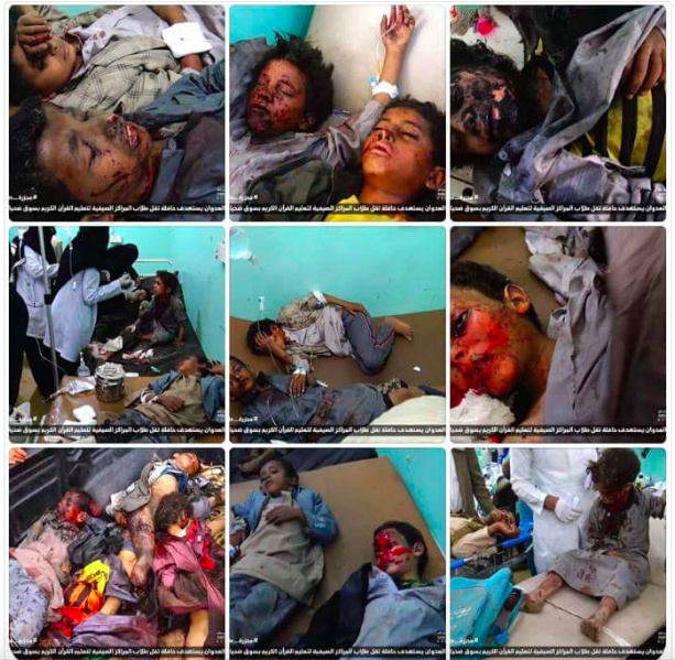 Yemen: Saudijci projektilom pogodili bus pun školaraca Slika_17