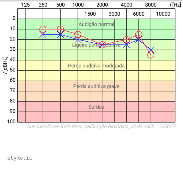 Review:  Protetor auricular - Etymotic, ProGuard, MusicSafePro Alpline e os baratezas... Audio_10