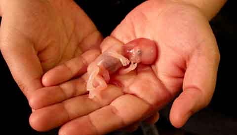 L'avortement criminalisé et thérapeutique  Avorte13