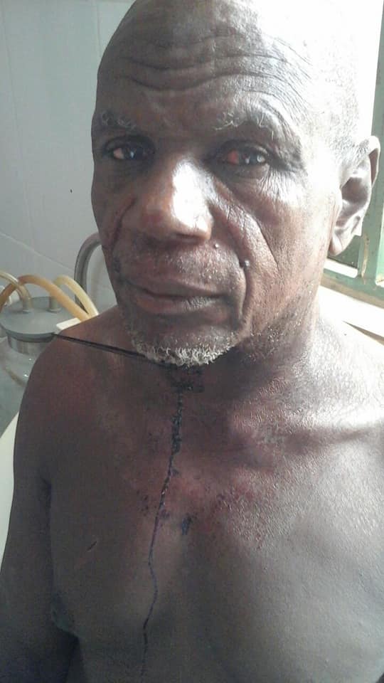 Fulani Man Escapes With Sharp Object In His Throat After Militia Attack (Graphic Photos) 1-3210