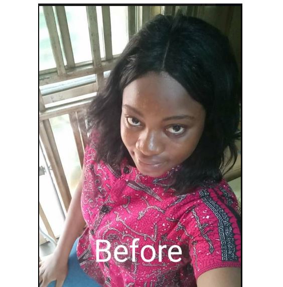 Lady Falls From Balcony Of 2-storey Building While Chatting (Photos) 1-7910