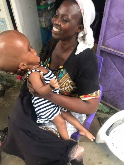 Little Baby In Pains As Her Head Continues To Swell Due To Medical Condition (Photos) 2-18210