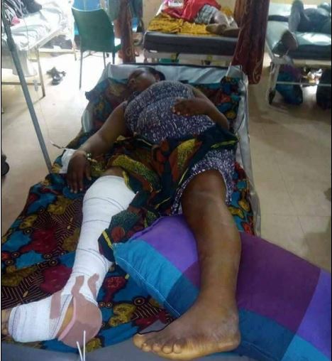 Lady Falls From Balcony Of 2-storey Building While Chatting (Photos) 3-3810