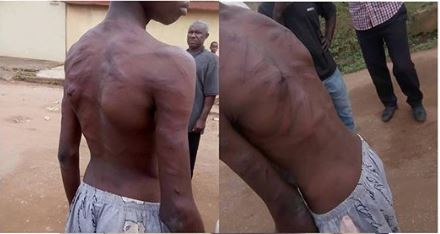Boy Brutalized By His Uncle In Lagos (Photo) Bi210