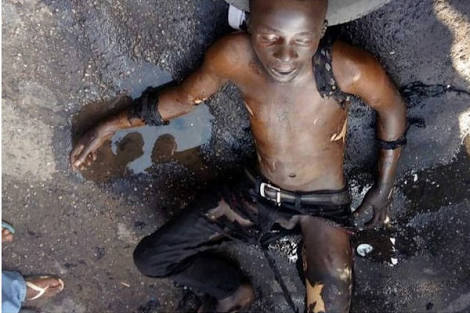 Drug Addict Who Set Himself Ablaze On Lagos Road Finally Dies Dies10