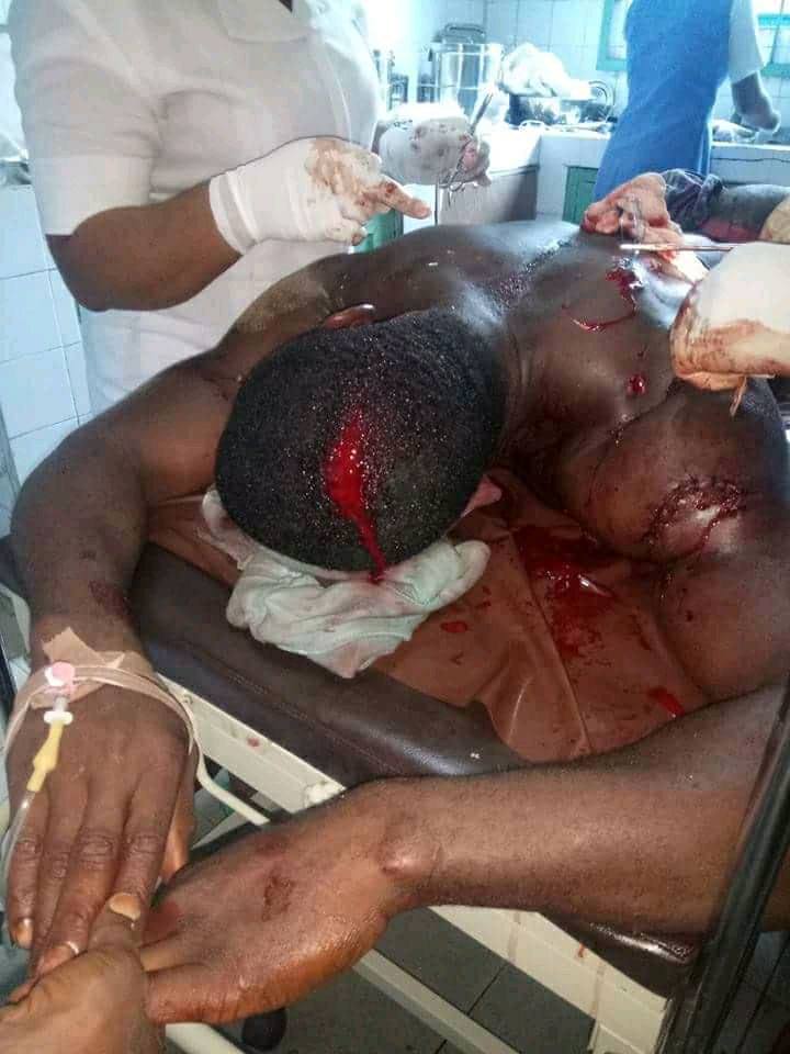 A Young Man Who Tries to Save a Lady From Been Molested Was Attacked By some Cultists(Graphic Photos)   Ekanem12