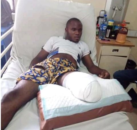 Young Man Loses Leg While Trying To Bribe Police Officers At A Checkpoint (See Photos) Man2-410