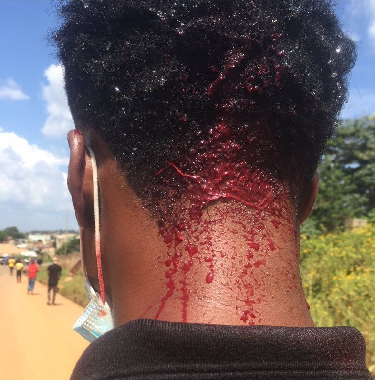 Photojournalist Reveals He Was Attacked By Ekiti #Endsars Protesters, Leaving Him With A Head Injury Photoj12