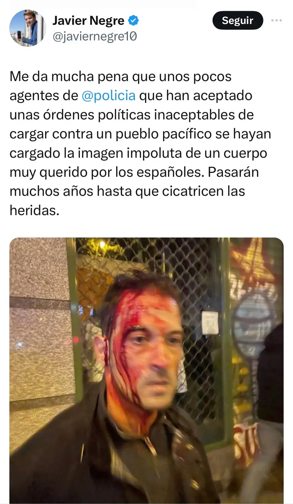 Protestas contra lo que está haciendo Sánchez  - Página 2 Img_2_11