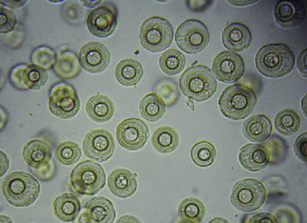 Paràsits externs unicelulars (protozoos) Tricho10