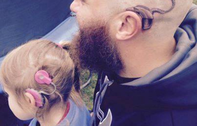 Pour soutenir sa fille sourde,un père (Alistair Campbell) se fait tatouer le même implant auditif 648x4114