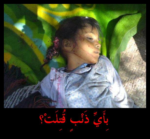 صور من مجزرة ابين 17 / 12 / 2009 تحكي بشاعة الرئيس اليمني علي عبد الله صالح 12345610