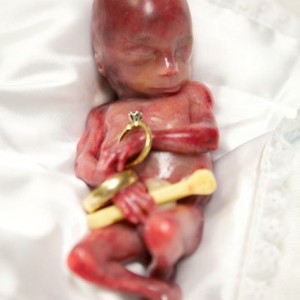 PHOTOS OF BABY WALTER, MISCARRIED AT 19 WEEKS, HELP SAVE CHILDREN FROM ABORTION Walter11