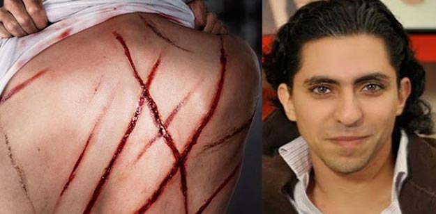  Raïf Badawi : 1000 coups de fouet et 10 ans de prison pour s’être exprimé Raef10