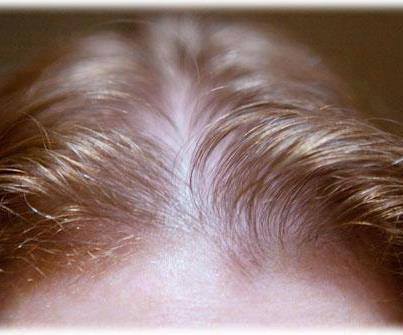 وصفة لتقوية الشعر الخفيف 11111126