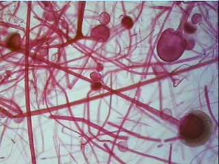 ^ ^   Genus Rhizopus  ^ ^ Rhizsp10