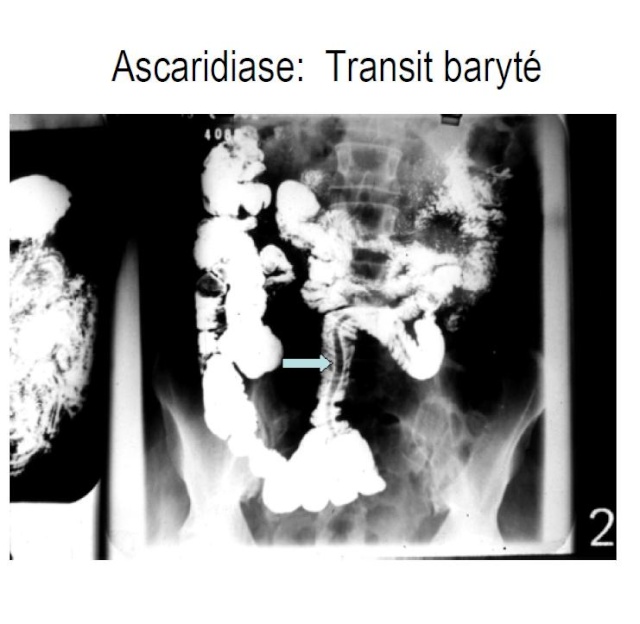 images; Parasitoses intestinales Pppppp10