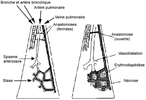 pathologie vasculaire (anapath) Schema10