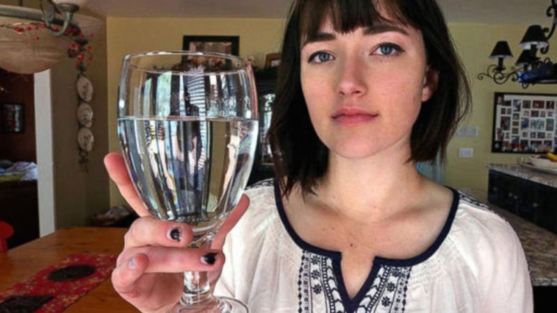 Alexandra Allen, 17 ans, allergique à l'eau Maladi10