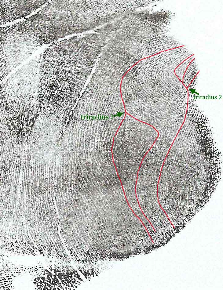 Two arches on Venus mount? Venus-11