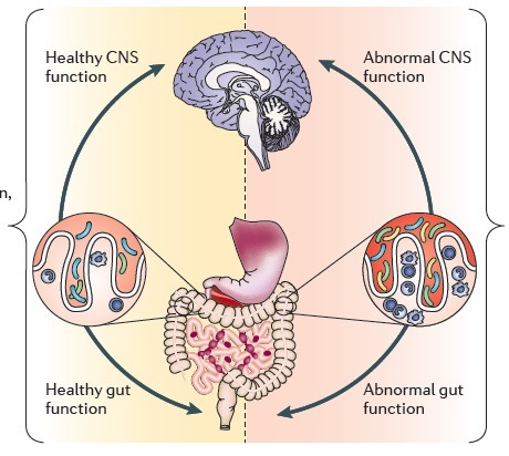 Altered Fecal Microbiota Composition in Patients with Major Depressive Disorder. Gut_br10