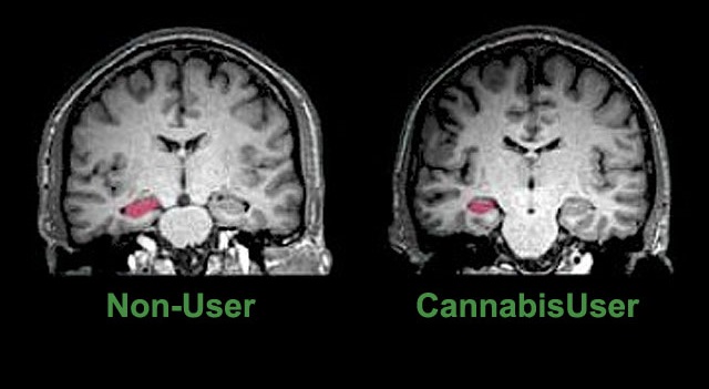 marijuanas-long-term-effects-on-brain-finally-revealed Cannab10