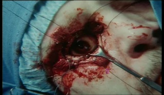 Body Bags (1993, John Carpenter & Tobe Hooper) Eye_210